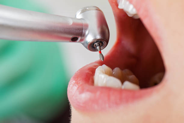 Best After-Hours Emergency Dentist in Brushy, OK